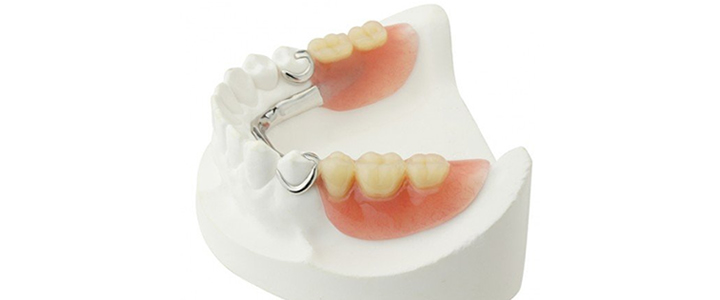 入れ歯専門の歯科技工士