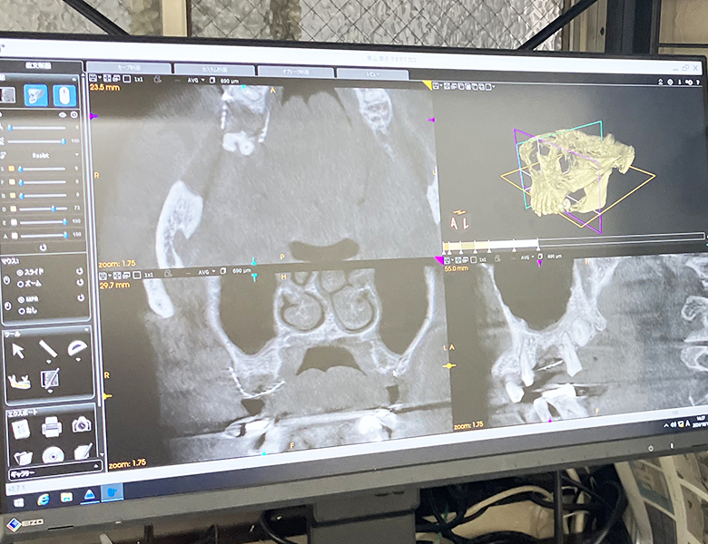 海老名市（社家駅）の歯医者、しゃけ駅前歯科の歯科用ＣＴ