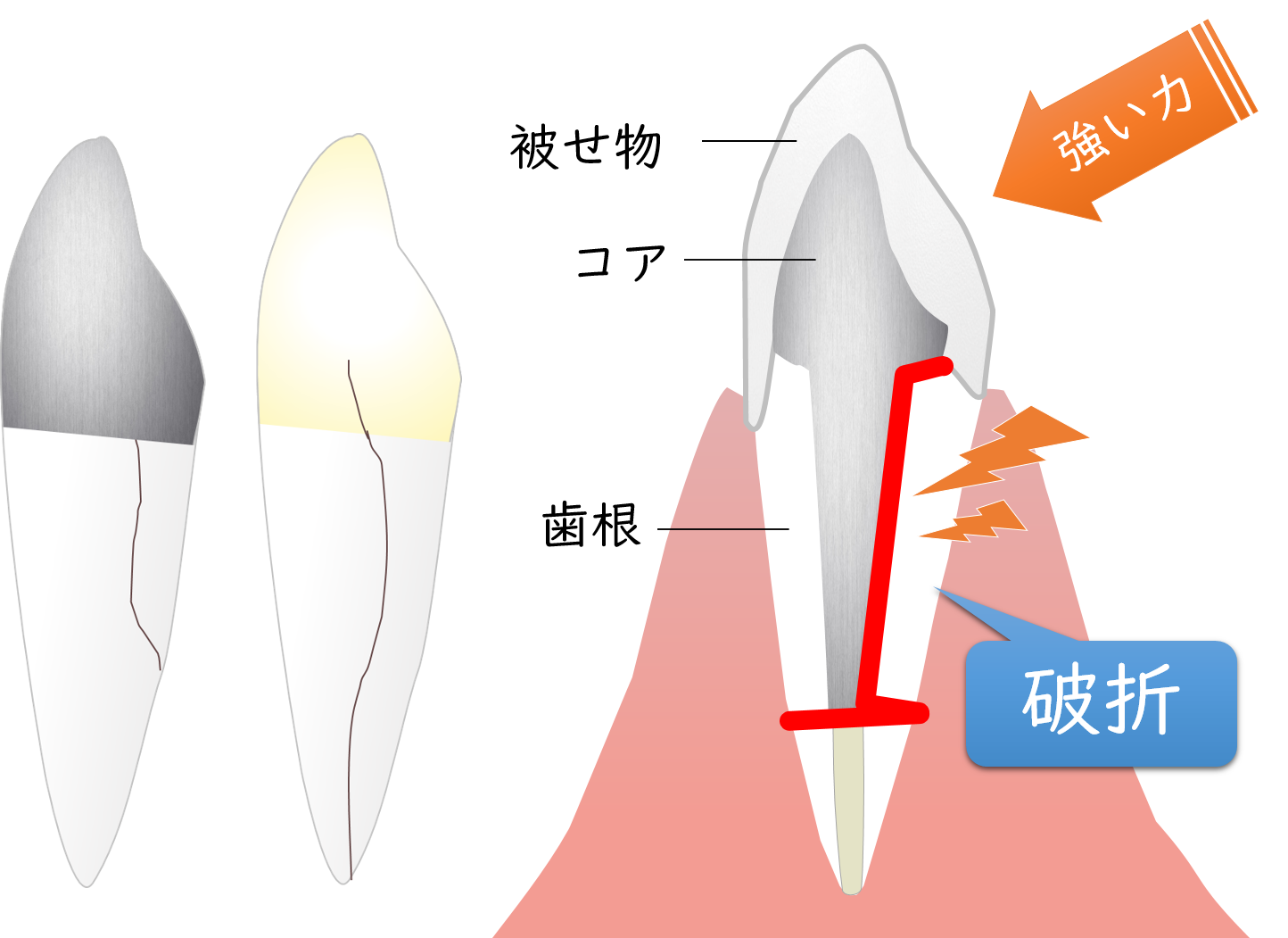 海老名市（社家駅）の歯医者、しゃけ駅前歯科の歯科用ＣＴ