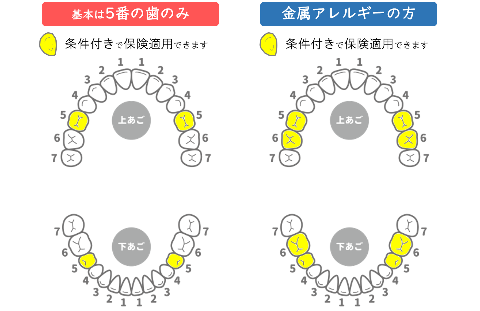 適用範囲